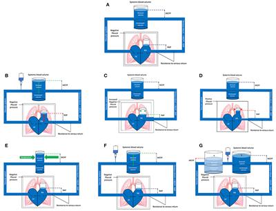 Frontiers | Assessment of Volume Status and Fluid Responsiveness